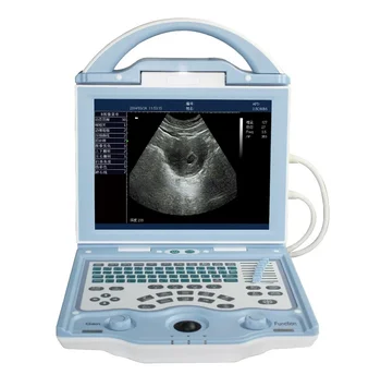 2016 novo začenja Cena Zdravje ultrazvočnih stroji SONCE-800W